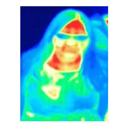 拍照片发现患癌症怎么回事 照片能拍出癌症吗 拍照片发现患癌症怎么回事 照片能拍出癌症吗