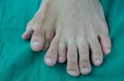 一足生9趾什么情况 详情画面曝光背后的原因引人深思