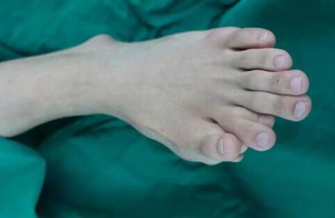 一足生9趾什么情况 详情画面曝光背后的原因引人深思