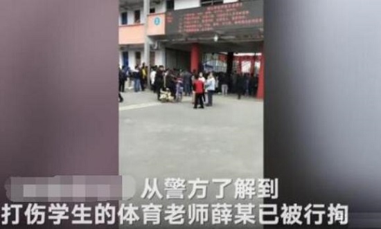 小学生被踢后身亡怎么回事 事件起因竟是因为这个! 小学生被踢后身亡怎么回事 事件起因竟是因为这个!