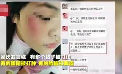 写错字被老师打伤怎么回事 事件始末详情曝光引得众怒 写错字被老师打伤怎么回事 事件始末详情曝光引得众怒