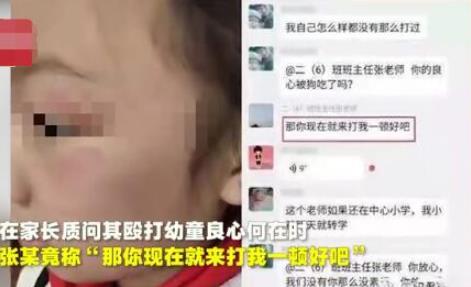 写错字被老师打伤怎么回事 事件始末详情曝光引得众怒 写错字被老师打伤怎么回事 事件始末详情曝光引得众怒