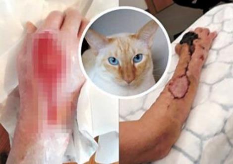 被猫咪抓伤险丧命什么情况 事情详情介绍竟是因为这个 被猫咪抓伤险丧命什么情况 事情详情介绍竟是因为这个