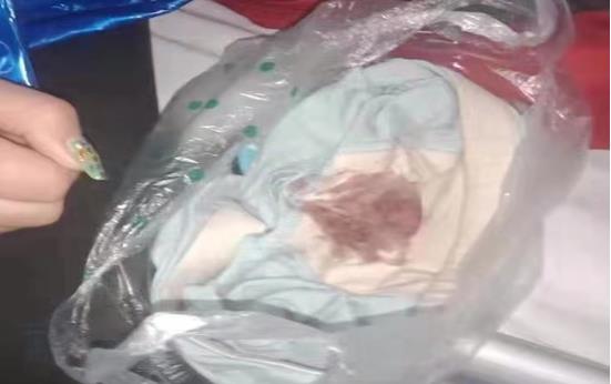 男童被老师踢伤怎么回事 事件始末详情及原因曝光