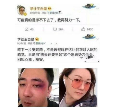 王自健被妻子家暴细节曝光 扇耳光烟头烫成家常便饭