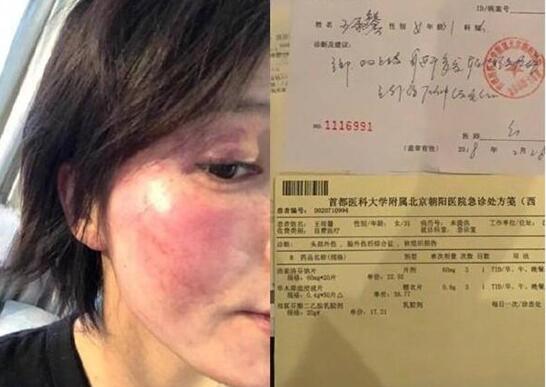 黄景瑜个人资料简介 黄景瑜妻子是谁黄景瑜家暴是真的吗 黄景瑜个人资料简介 黄景瑜妻子是谁黄景瑜家暴是真的吗