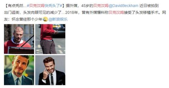 贝克汉姆快秃头了什么情况 现场画面曝光真相原来是这样! 贝克汉姆快秃头了什么情况 现场画面曝光真相原来是这样!