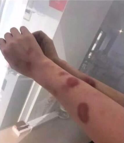 曝黄景瑜前女友自杀未遂怎么回事 黄景瑜昔日隐婚家暴事件大起底 曝黄景瑜前女友自杀未遂怎么回事 黄景瑜昔日隐婚家暴事件大起底