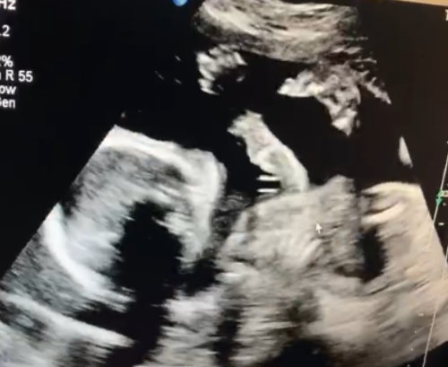 GAI当爸 晒B超照及妻子孕妇照心情激动