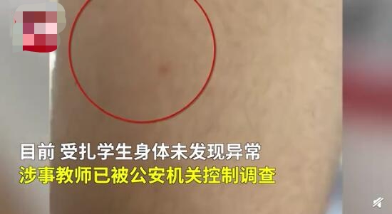 老师用圆规扎未完成作业学生 事件始末详情及后续经过介绍