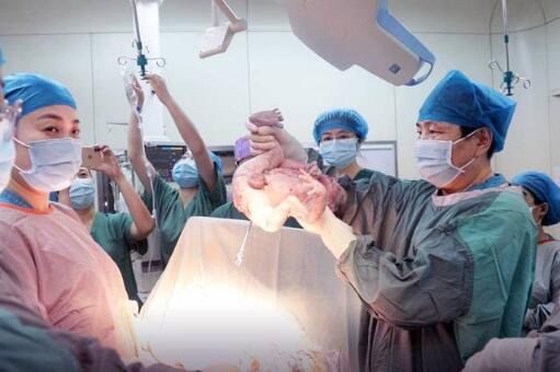 湖北一双胞胎兄弟相差10岁什么情况 事件详情介绍真相来了 湖北一双胞胎兄弟相差10岁什么情况 事件详情介绍真相来了