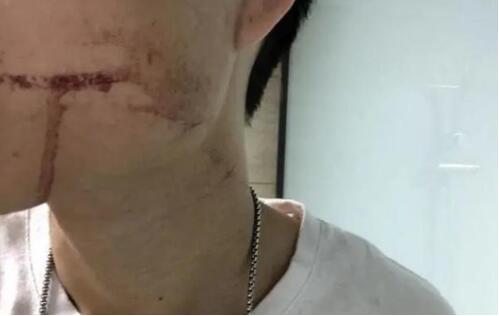 小伙拔牙10天后脑出血死亡 事件始末详情曝光真相原来是这样 小伙拔牙10天后脑出血死亡 事件始末详情曝光真相原来是这样