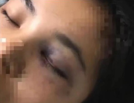 女子不堪家暴跳楼双下肢截瘫 家暴画面曝光公公曾扬言杀死女子哥哥