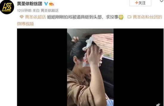 黄圣依拍戏时头部受伤 头捂额头血流不止疼到吸气 黄圣依拍戏时头部受伤 头捂额头血流不止疼到吸气