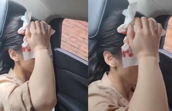 黄圣依拍戏时头部受伤 头捂额头血流不止疼到吸气 黄圣依拍戏时头部受伤 头捂额头血流不止疼到吸气