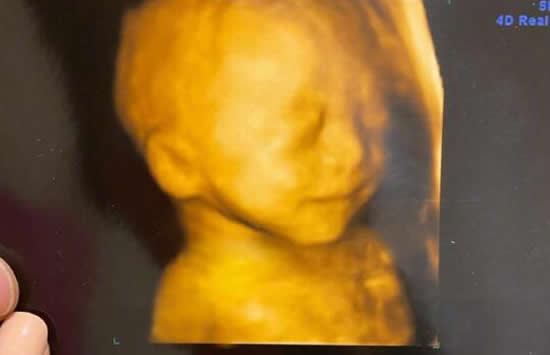 13届快男宁桓宇当爸 妻子资料及宝宝小名曝光 13届快男宁桓宇当爸 妻子资料及宝宝小名曝光