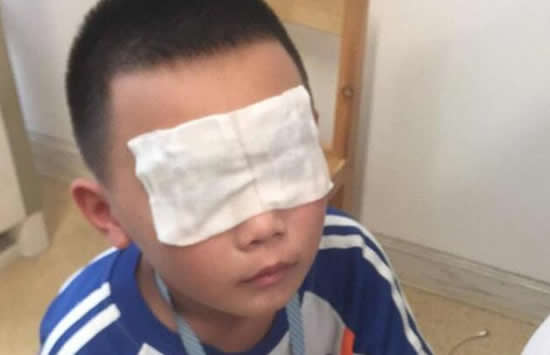 小学误开紫外线灯灼伤学生眼睛 事件背后的原因究竟是什么 小学误开紫外线灯灼伤学生眼睛 事件背后的原因究竟是什么