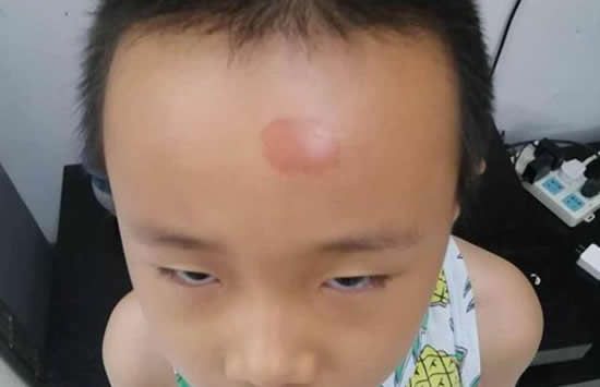 小学误开紫外线灯灼伤学生眼睛 事件背后的原因究竟是什么 小学误开紫外线灯灼伤学生眼睛 事件背后的原因究竟是什么