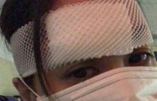 阿娇或需再做手术受伤细节曝光 前夫不理阿娇受伤传闻与美女教练晒合照