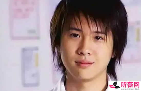 李智楠的脸怎么了 李智楠割双眼皮了吗 李智楠的脸怎么了 李智楠割双眼皮了吗