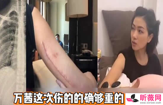 万茜人淡如菊是什么梗 万茜人设塌了吗 万茜人淡如菊是什么梗 万茜人设塌了吗