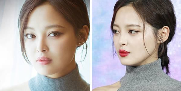 辛芷蕾嘴唇是怎么回事? 辛芷蕾嘴唇是怎么回事?