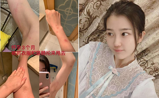 张漠寒被家暴是怎么回事 张漠寒个人资料简历及图片