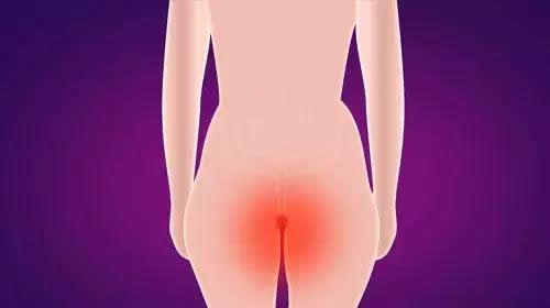 痔疮偏方19个民间方法:民间流传有效简单实用 痔疮偏方19个民间方法:民间流传有效简单实用