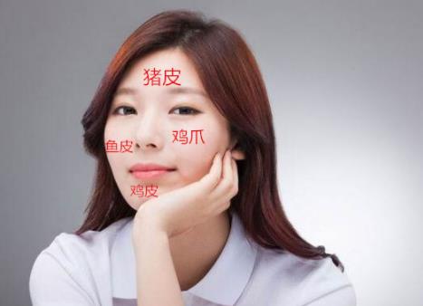 满脸胶原蛋白是什么意思;满脸胶原蛋白是个什么鬼 满脸胶原蛋白是什么意思;满脸胶原蛋白是个什么鬼