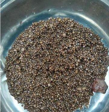 右肾2980颗结石:狭小空间挤满了数不清的结石 右肾2980颗结石:狭小空间挤满了数不清的结石