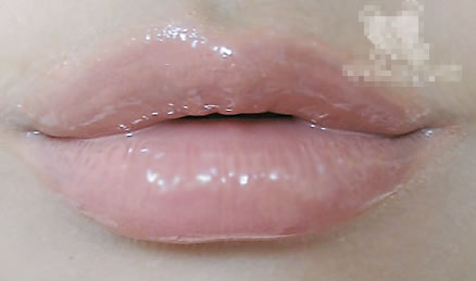 蝴蝶唇图片：蝴蝶阴唇是怎么回事,蝴蝶唇长什么样子