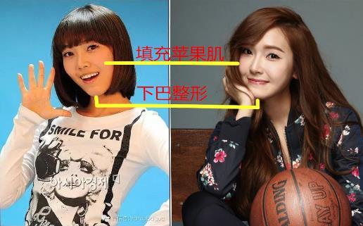 郑秀妍整容后更美了：郑秀妍整容前后照对比（图）