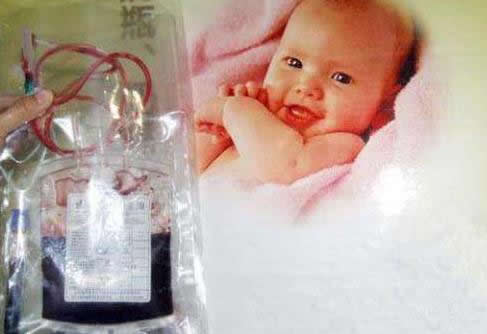 脐带血有必要保存吗?关于脐带血的问题解读