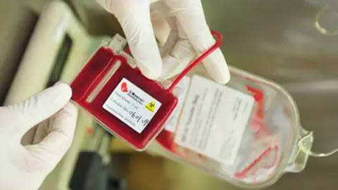 脐带血有必要保存吗?关于脐带血的问题解读