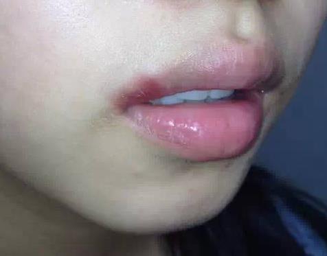 睡觉磨牙:为什么睡觉还会磨牙,怎么改善睡觉磨牙 睡觉磨牙:为什么睡觉还会磨牙,怎么改善睡觉磨牙