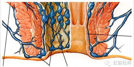 痔疮长什么样子的图片：痔疮是什么,图说痔疮