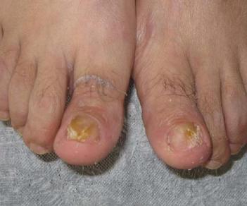 寿命长不长 看脚上有无三特点就知道(图) 寿命长不长 看脚上有无三特点就知道(图)