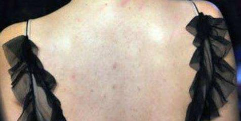 毛孔挤出这个暗示身上肝毒多(图) 毛孔挤出这个暗示身上肝毒多(图)