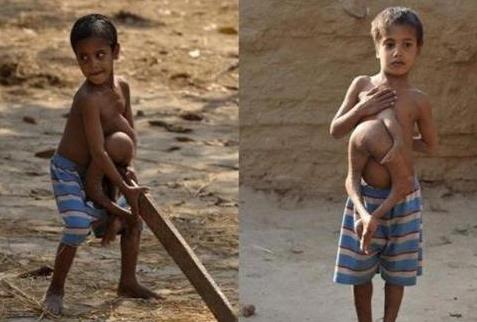 怪胎惊天兽:不可思议世界怪胎资料及图片 怪胎惊天兽:不可思议世界怪胎资料及图片