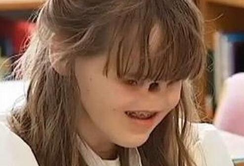 怪胎惊天兽:不可思议世界怪胎资料及图片 怪胎惊天兽:不可思议世界怪胎资料及图片