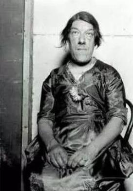 怪胎惊天兽：不可思议世界怪胎资料及图片