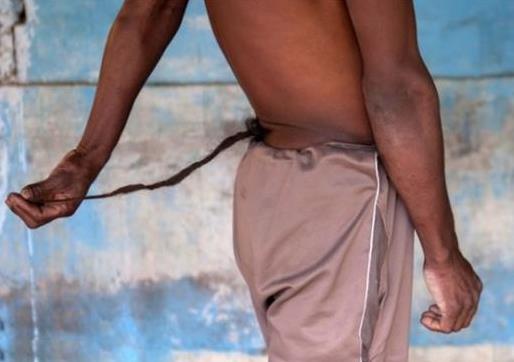 怪胎惊天兽：不可思议世界怪胎资料及图片