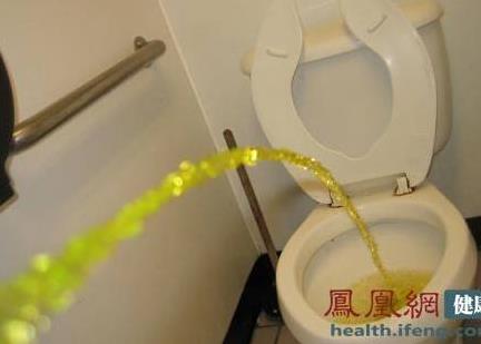 小便黄是什么原因：有危害吗,尿黄相关知识