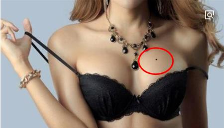 女人乳房长痣:女人胸部有痣各部位意思 女人乳房长痣:女人胸部有痣各部位意思