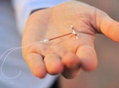 取环后注意事项:看看医生的解答(图) 取环后注意事项:看看医生的解答(图)