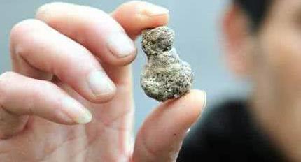 结石不能吃什么:祸从口入一定要严格把控 结石不能吃什么:祸从口入一定要严格把控