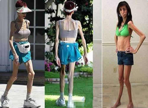 丑的女人:吉尼斯丑女与自封丑女对比图 丑的女人:吉尼斯丑女与自封丑女对比图