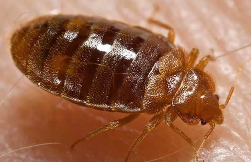 头上长虱子怎么办：长发美女头上长虱子要剃光头吗