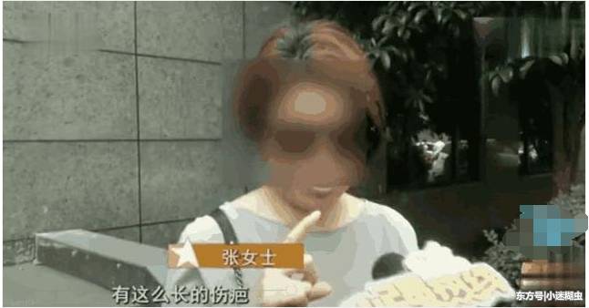 女子胸部太大的烦恼：结果去做缩胸手术