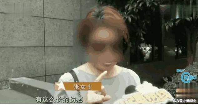 女子胸部太大的烦恼：结果去做缩胸手术